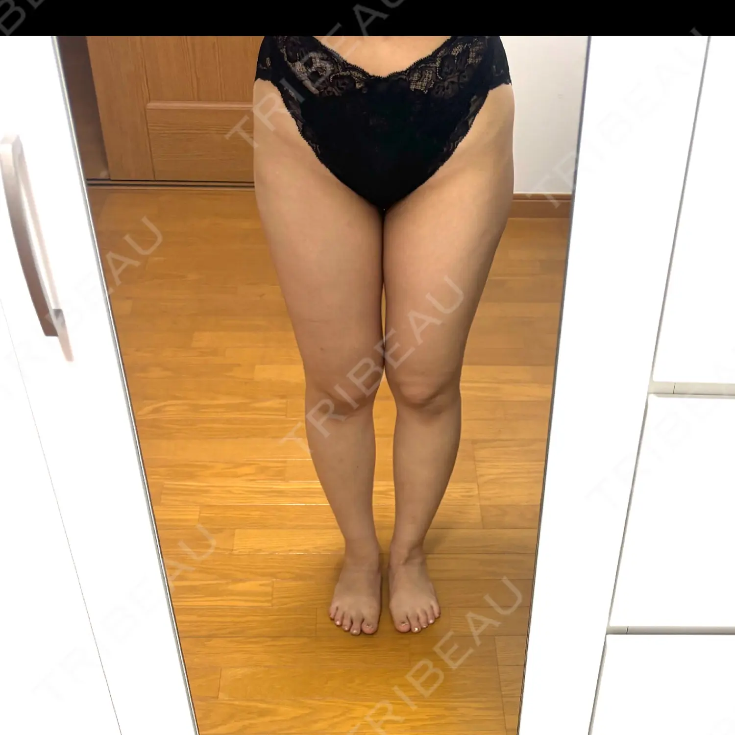 施術前の写真