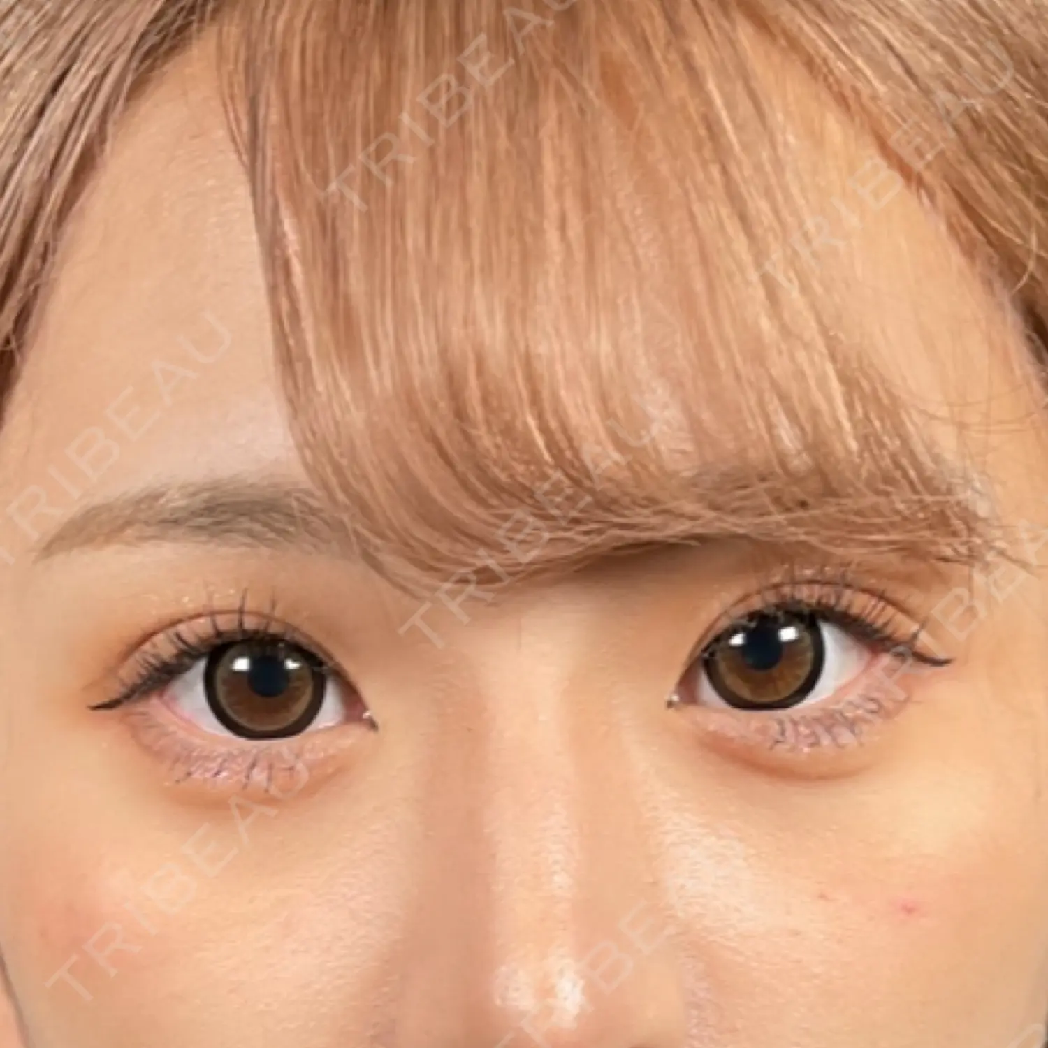 施術前の写真