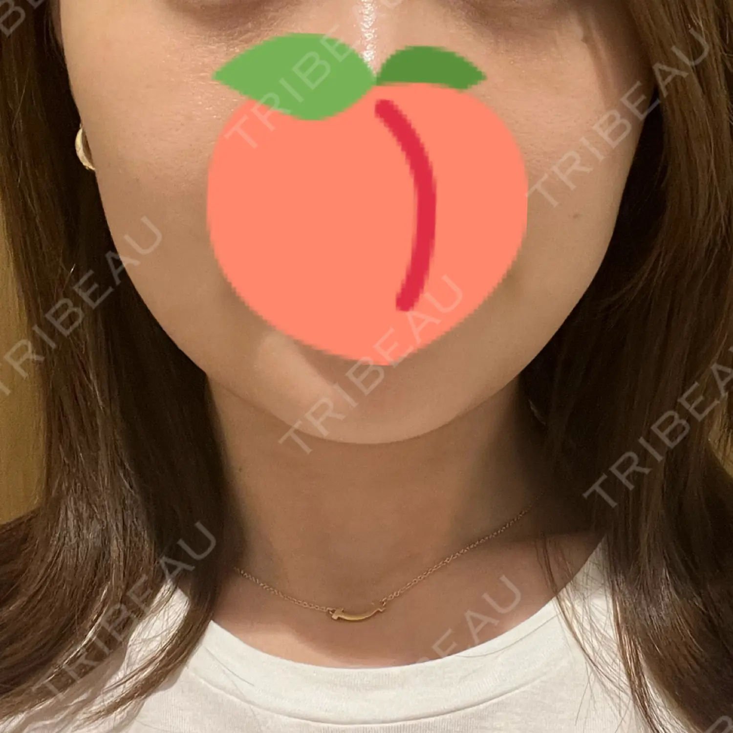 施術前の写真