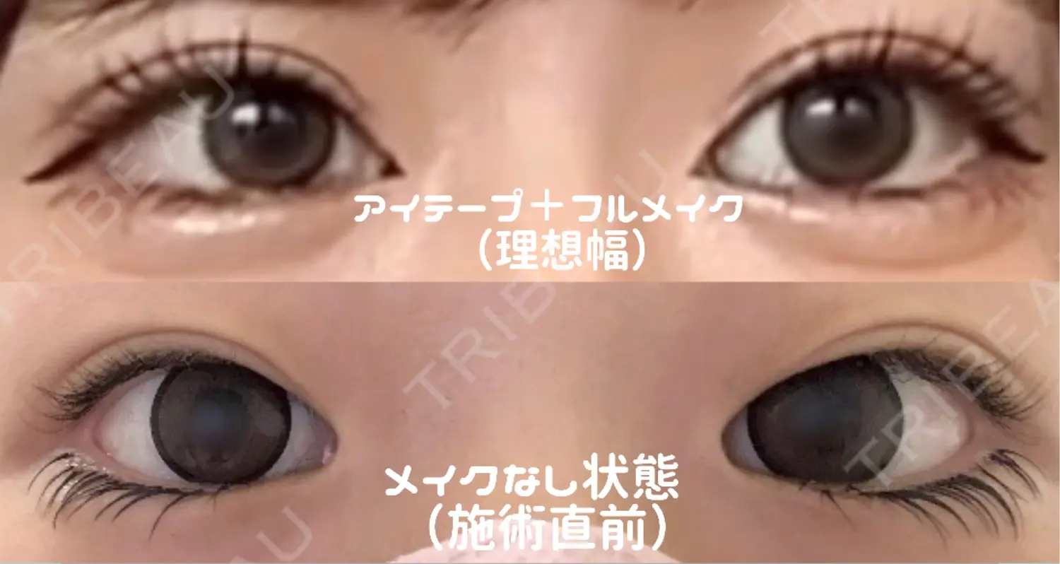 施術前の写真