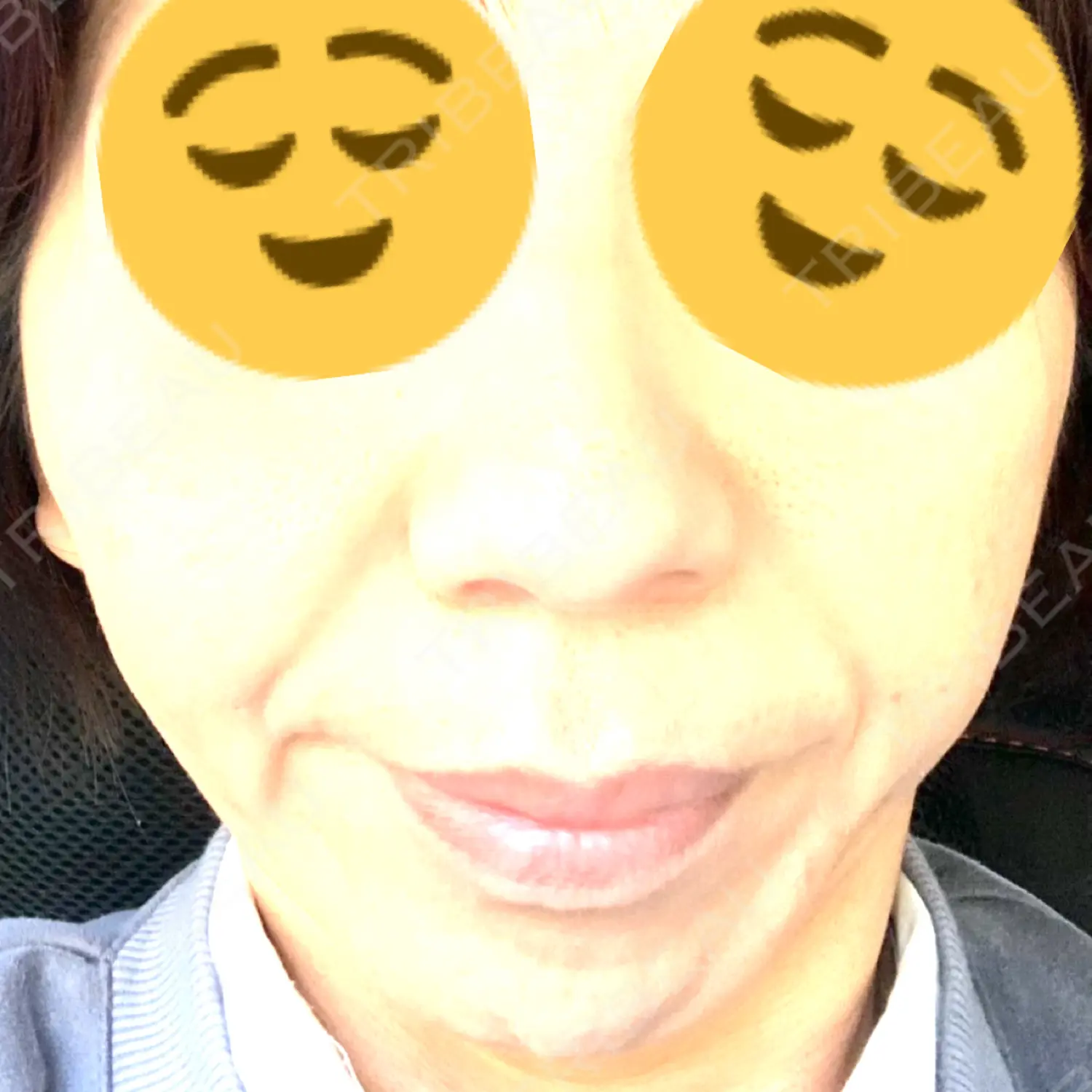 施術前の写真