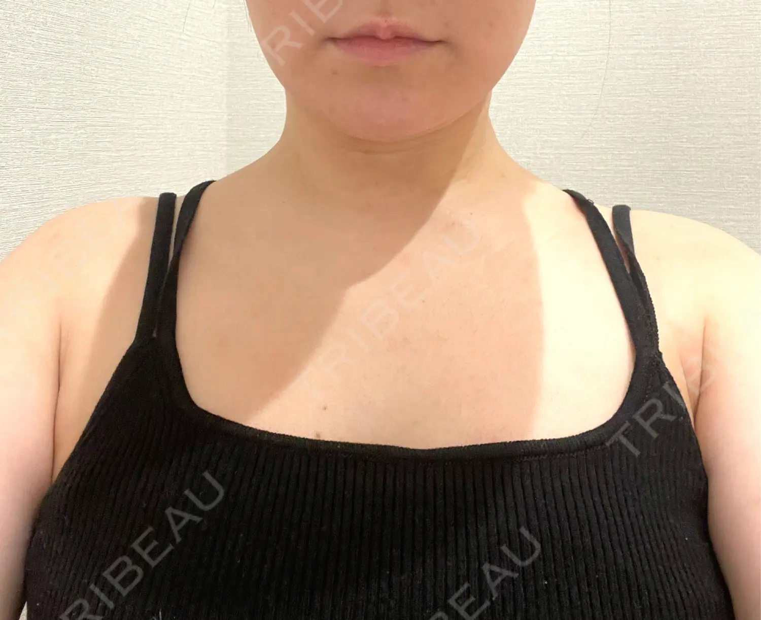 施術前の写真