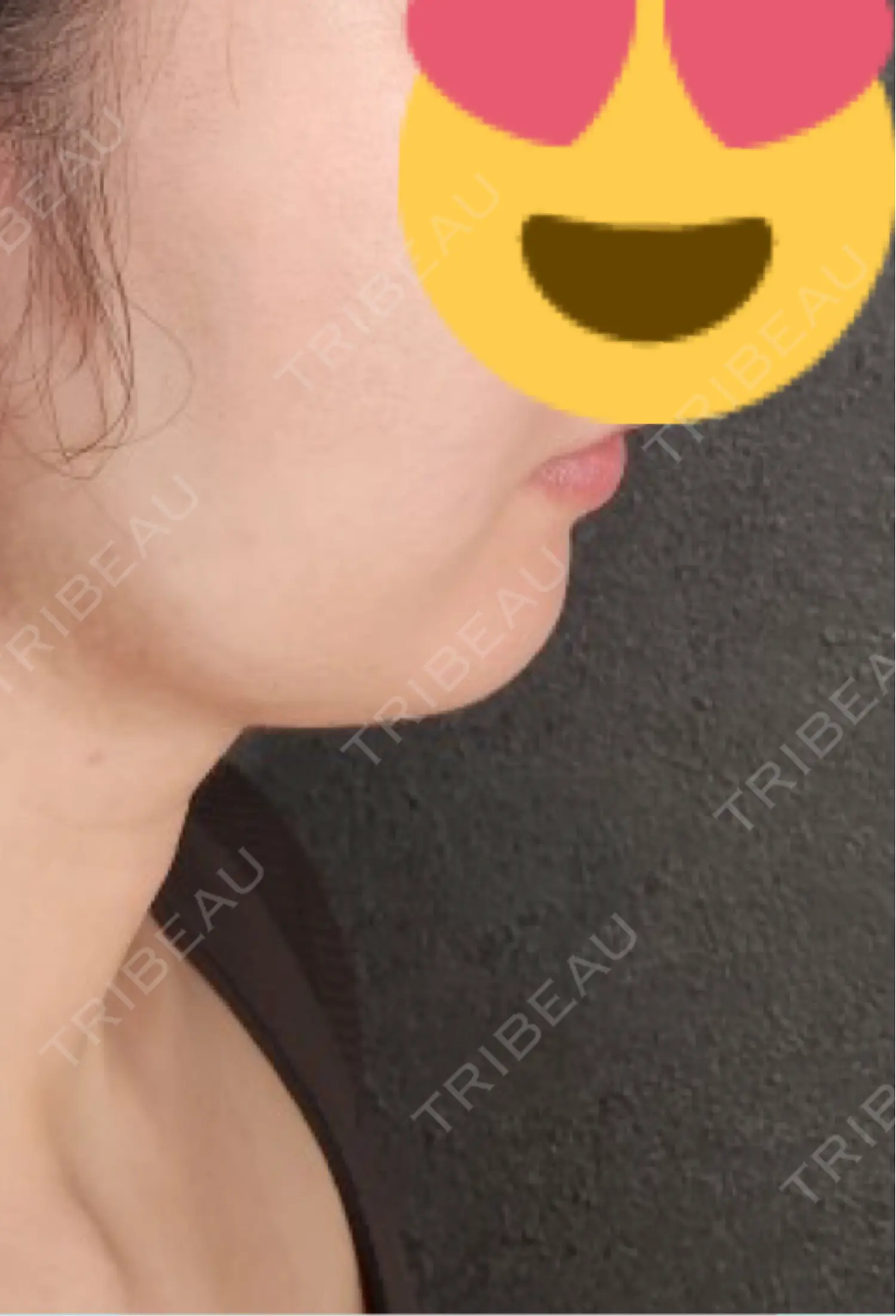 施術前の写真