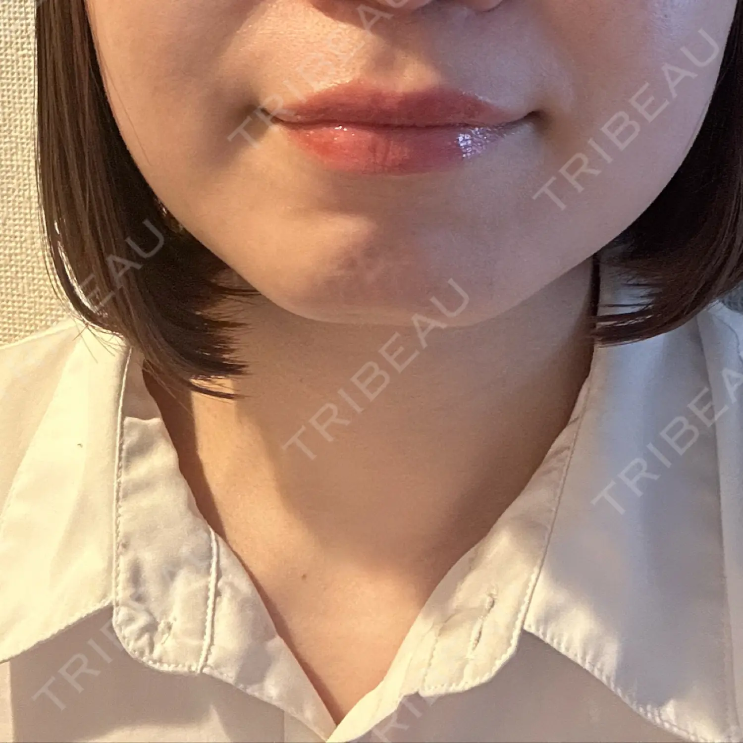 施術前の写真