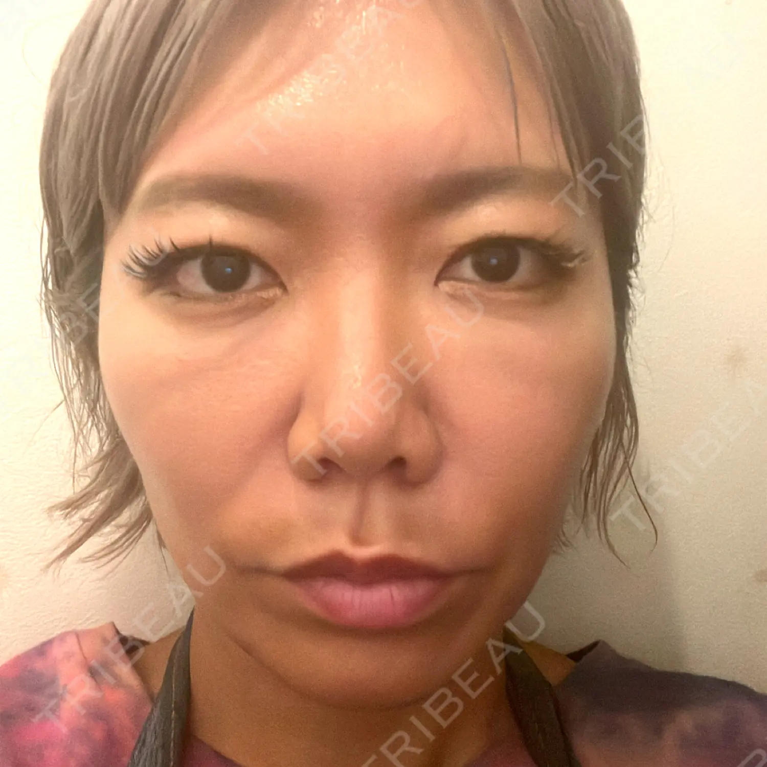 施術前の写真