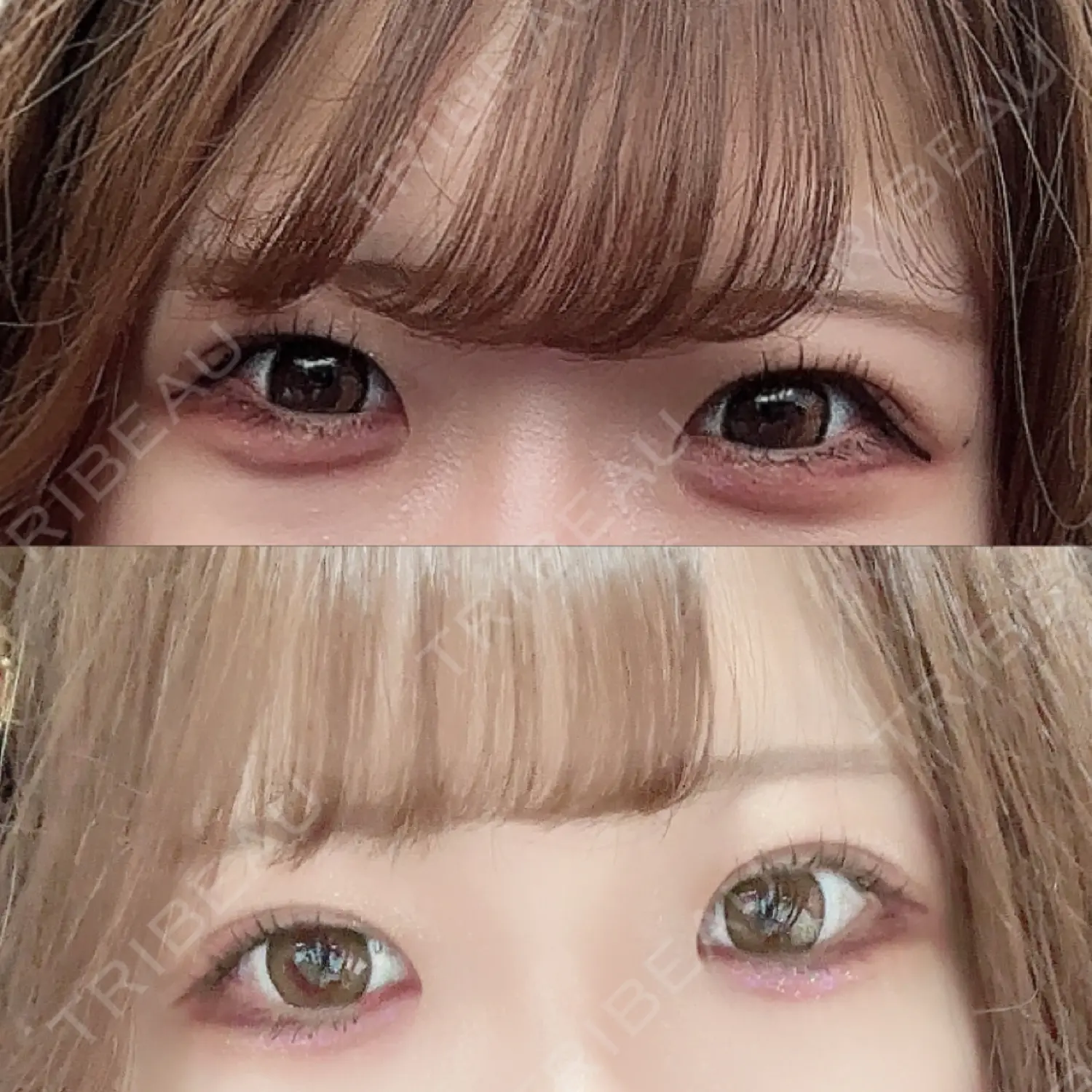 施術前の写真