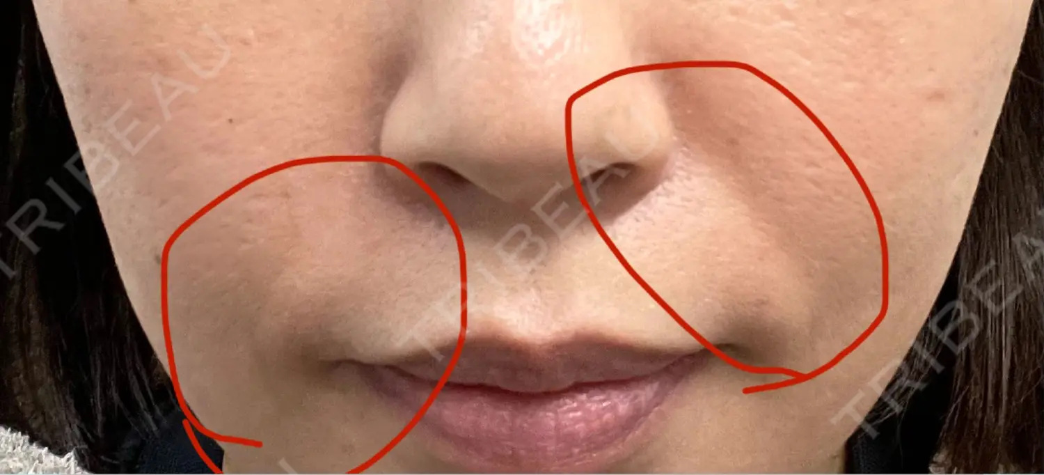 施術前の写真