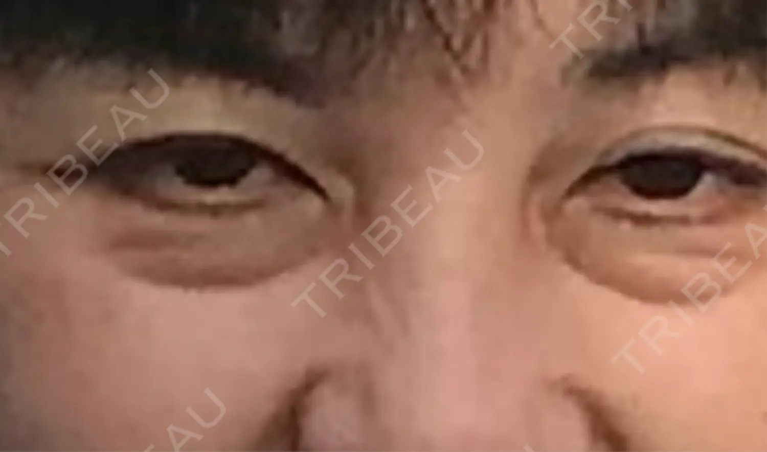 施術前の写真