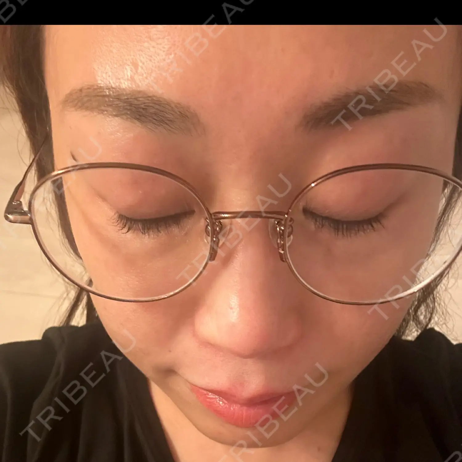 施術前の写真