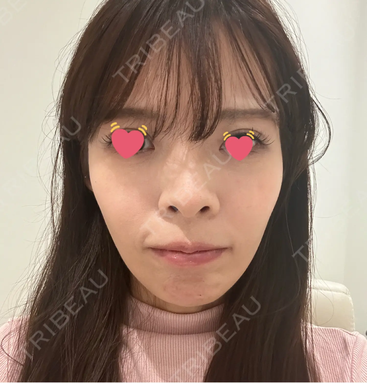 施術前の写真