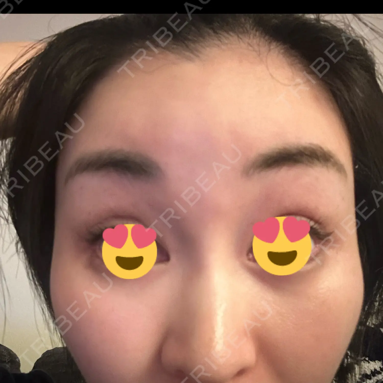 施術前の写真
