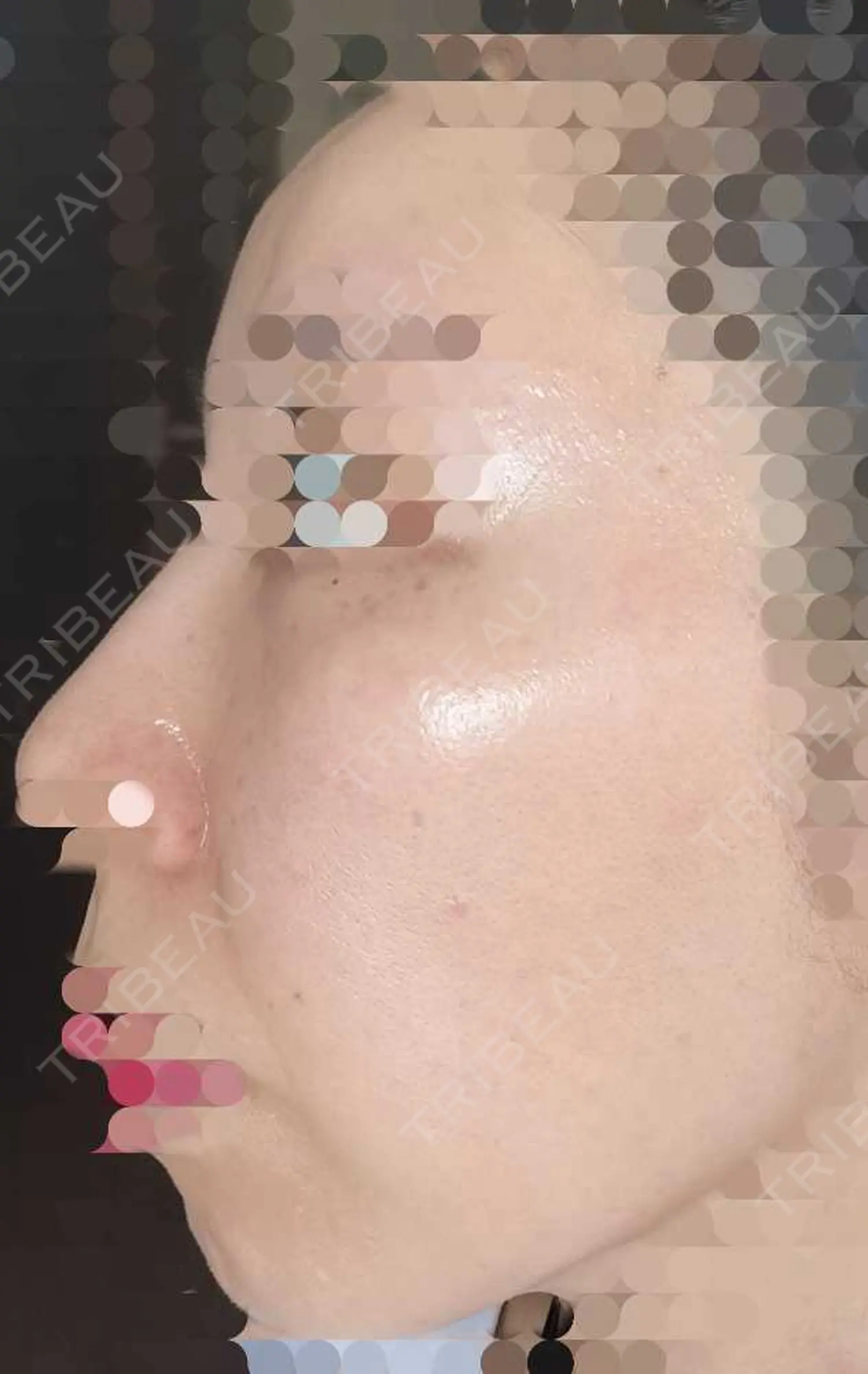 施術前の写真