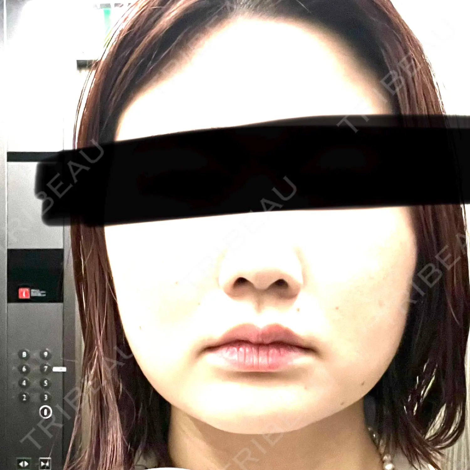 施術前の写真