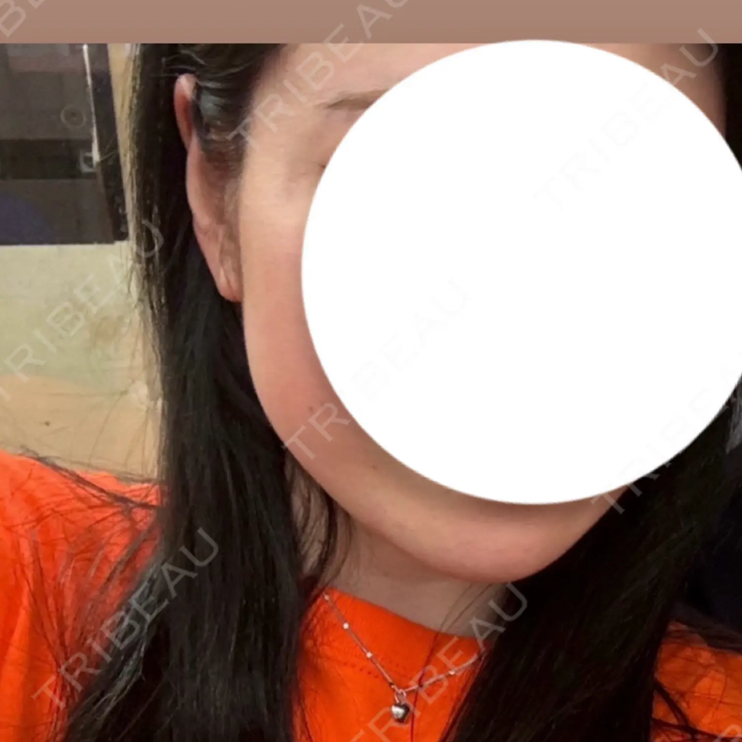 施術前の写真