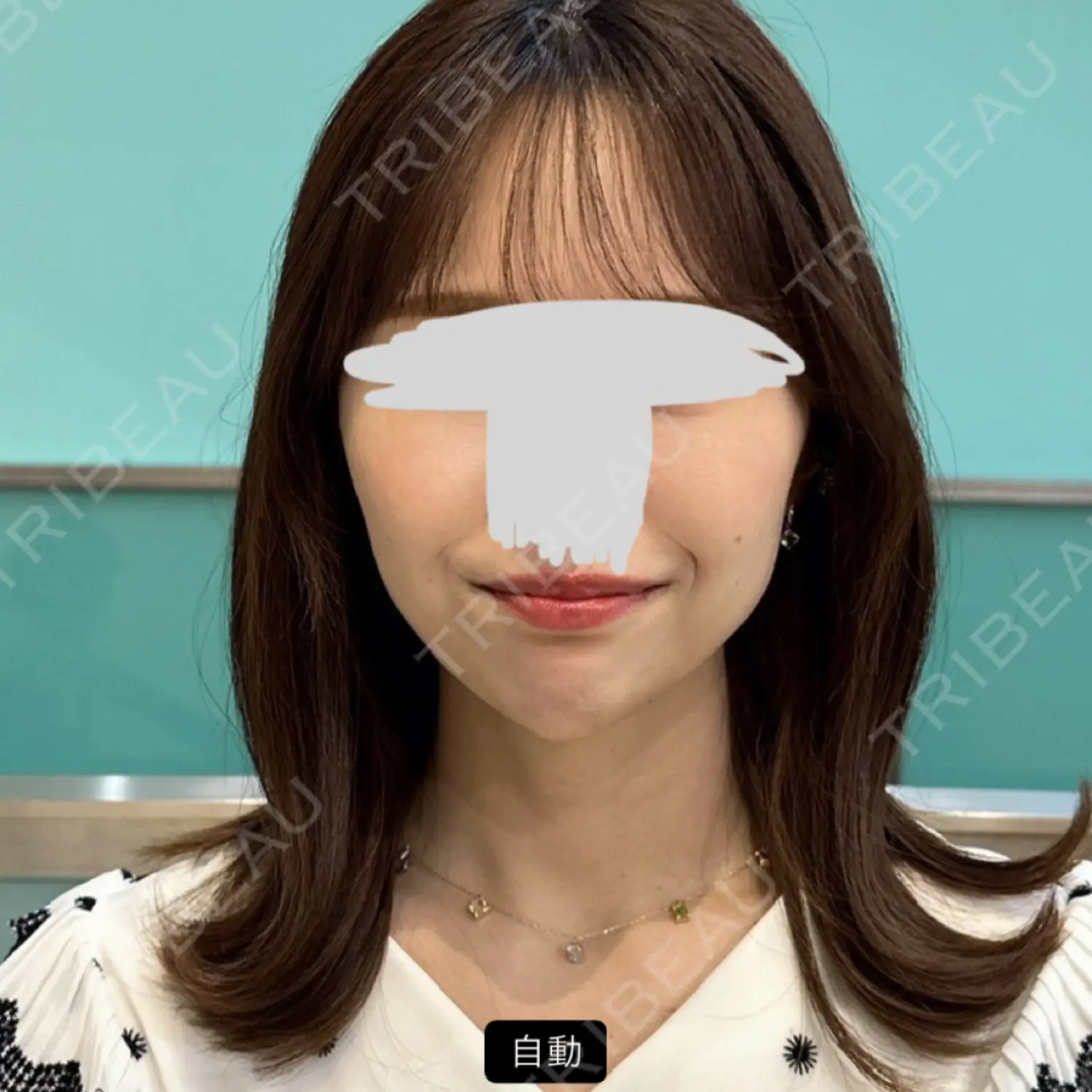 施術前の写真