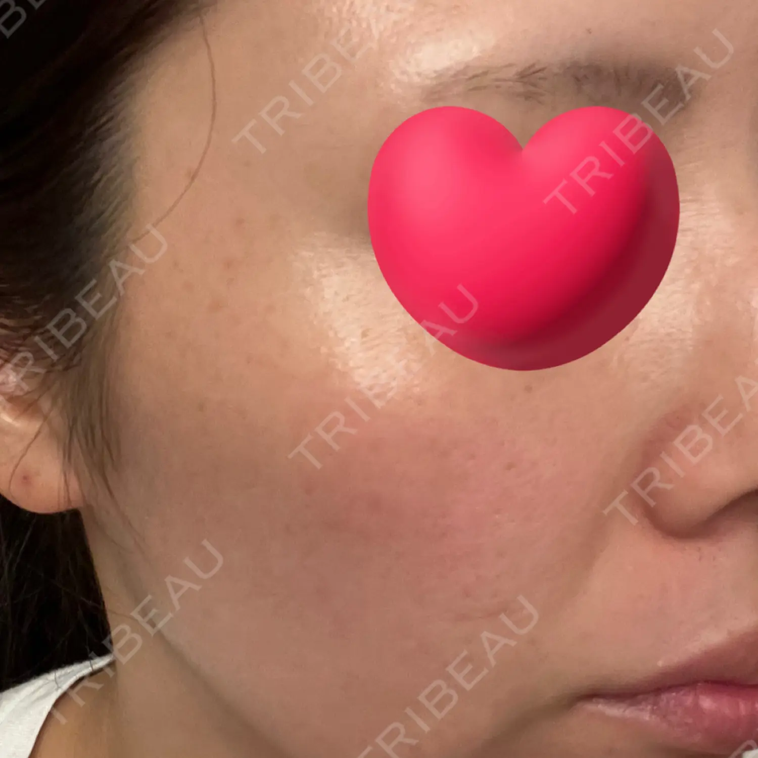 施術前の写真