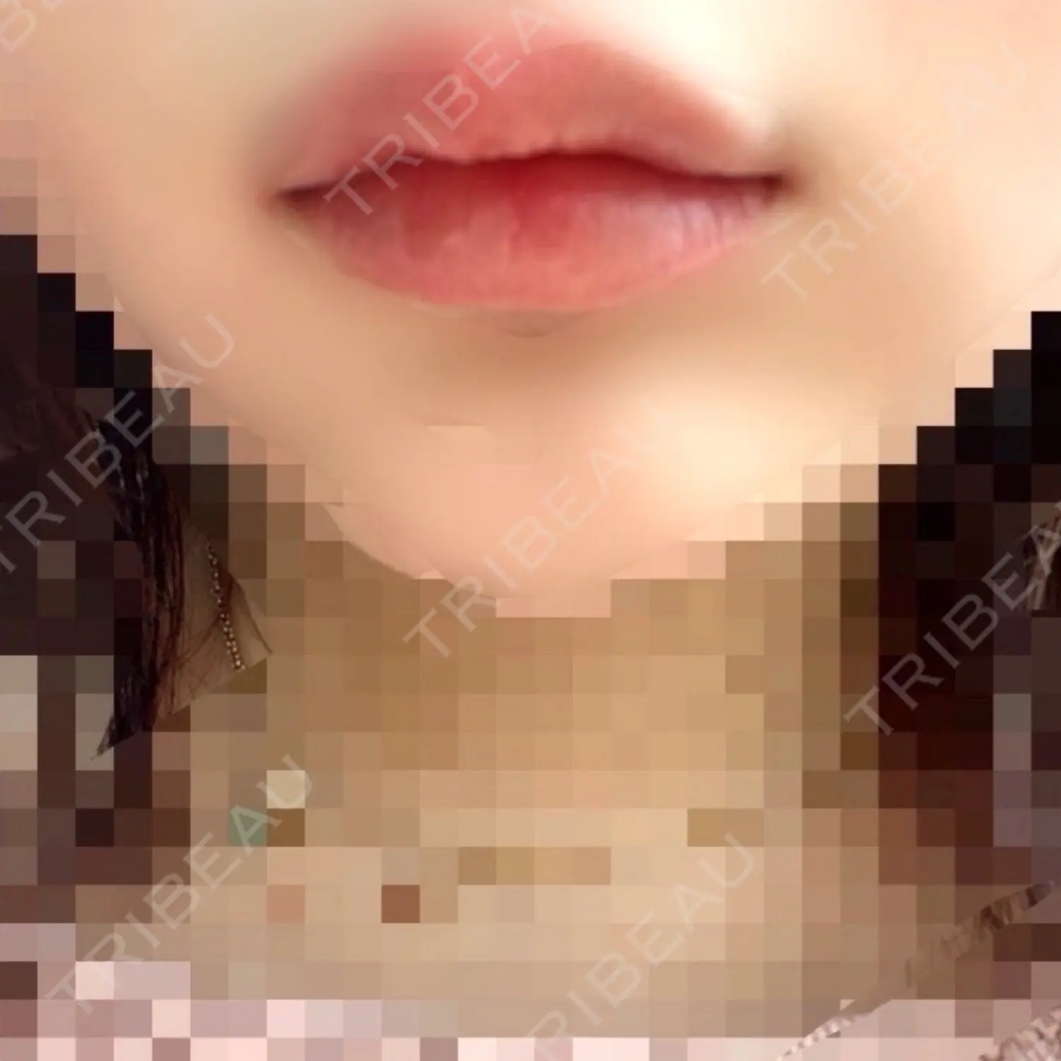 施術前の写真