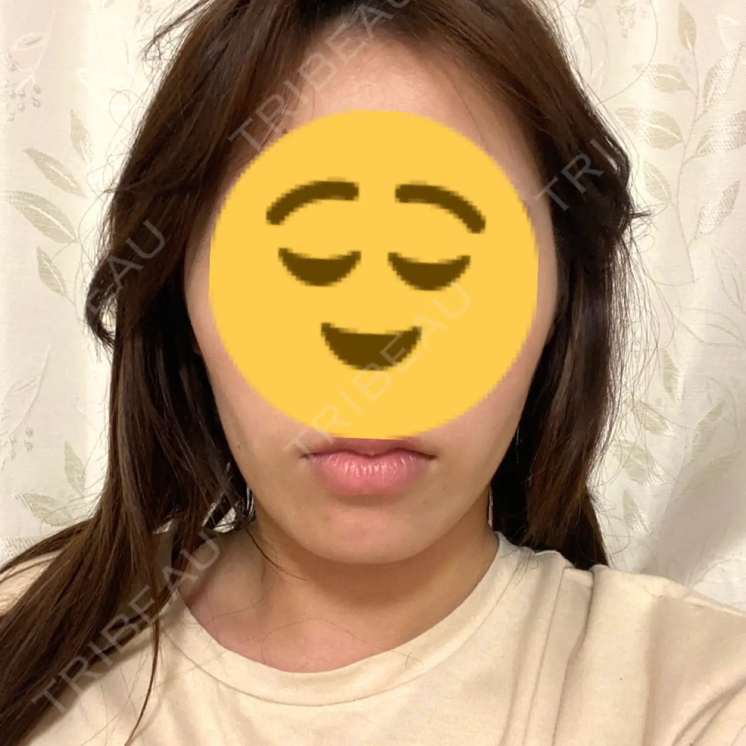 施術前の写真