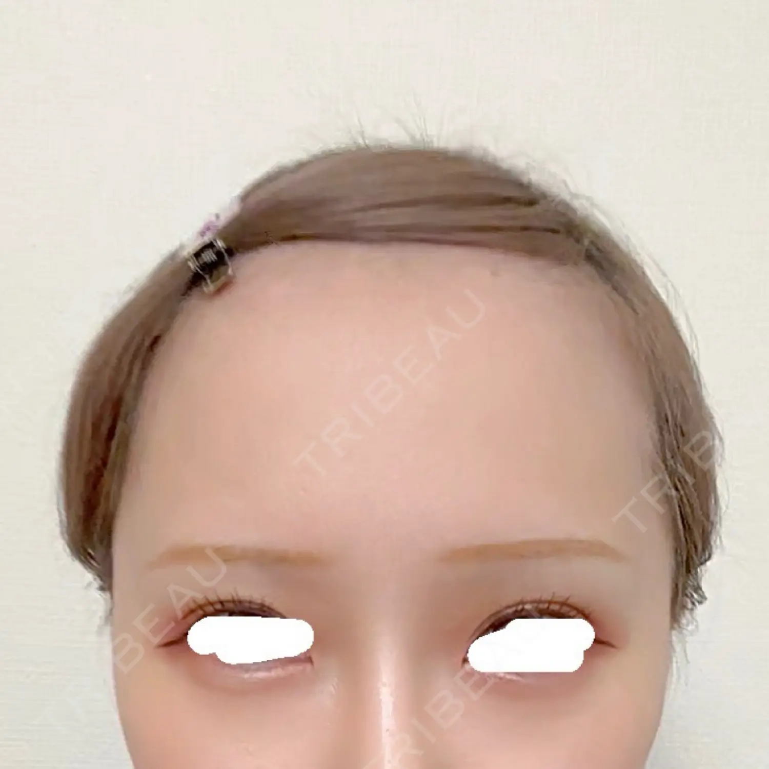 施術前の写真