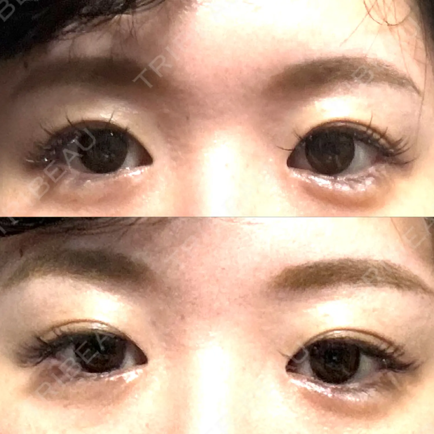 施術前の写真