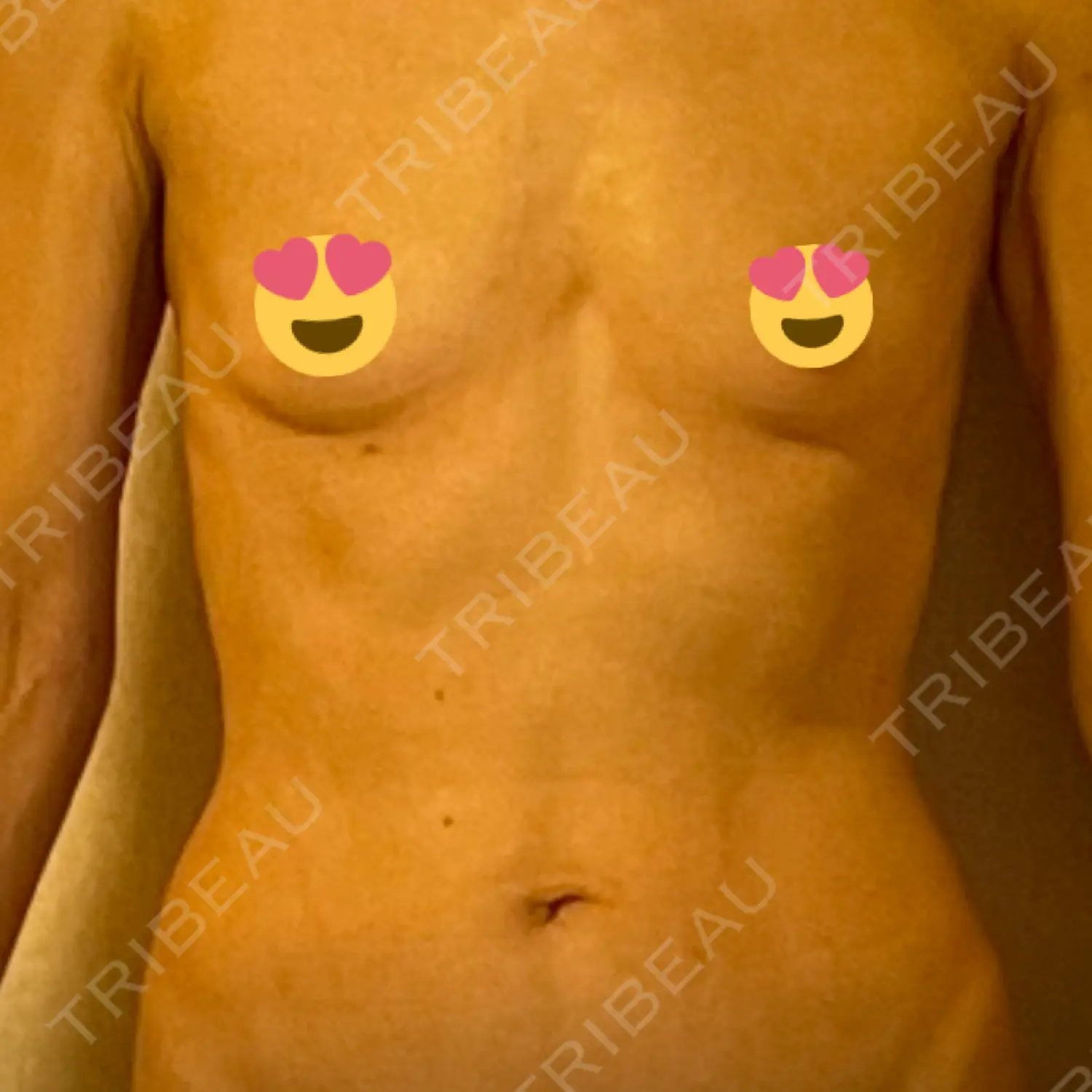 施術前の写真