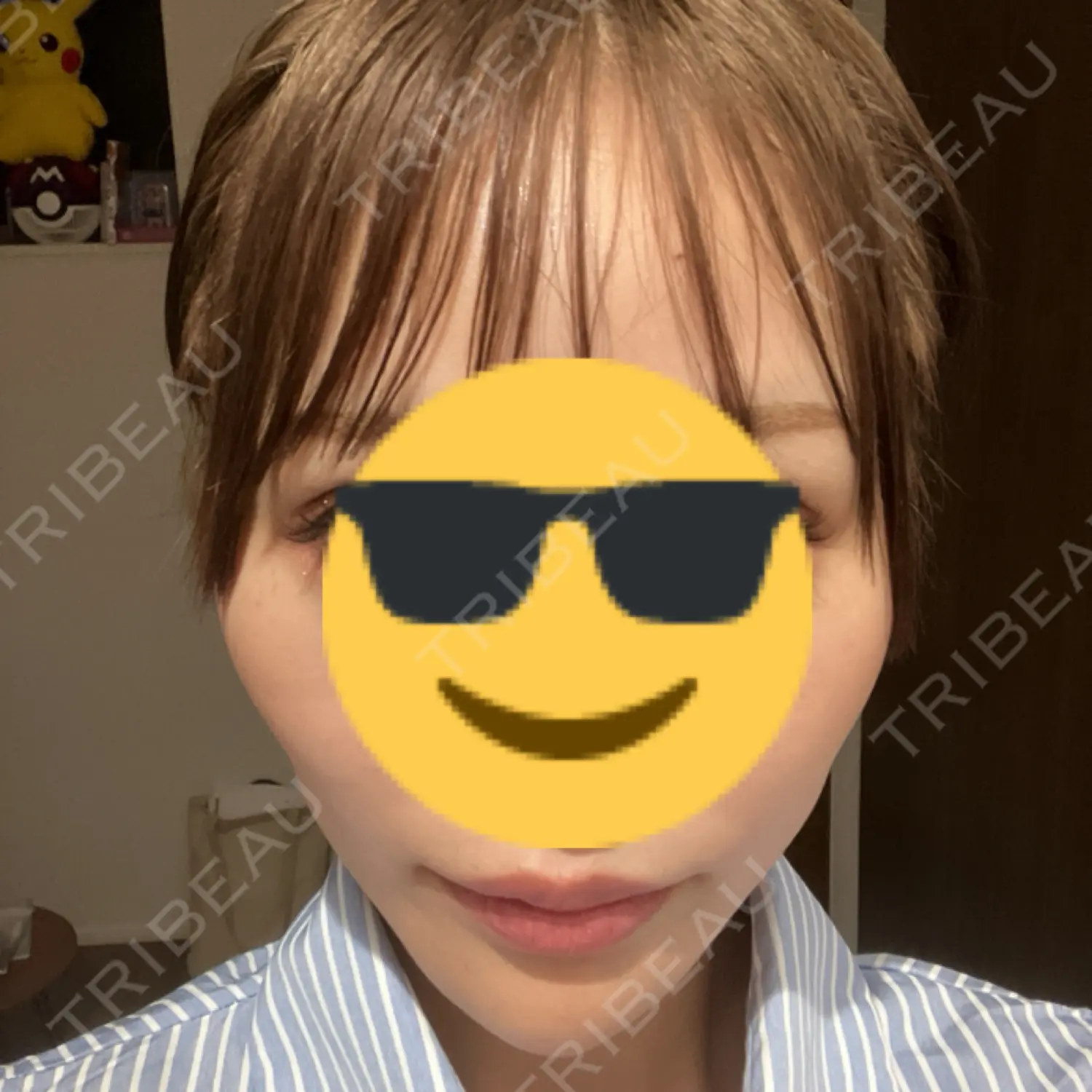 施術前の写真