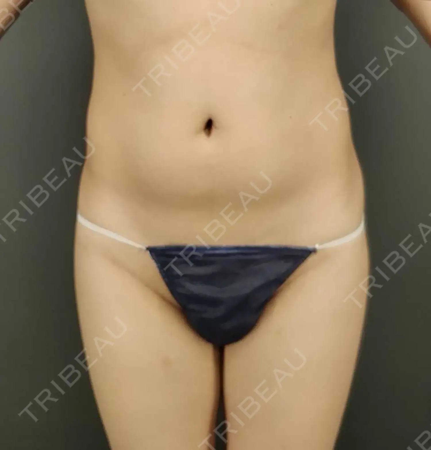 施術前の写真