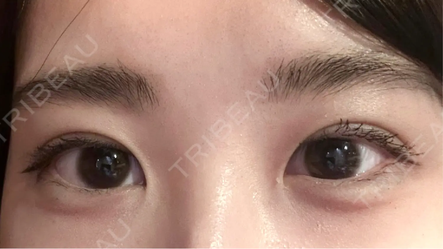 施術前の写真