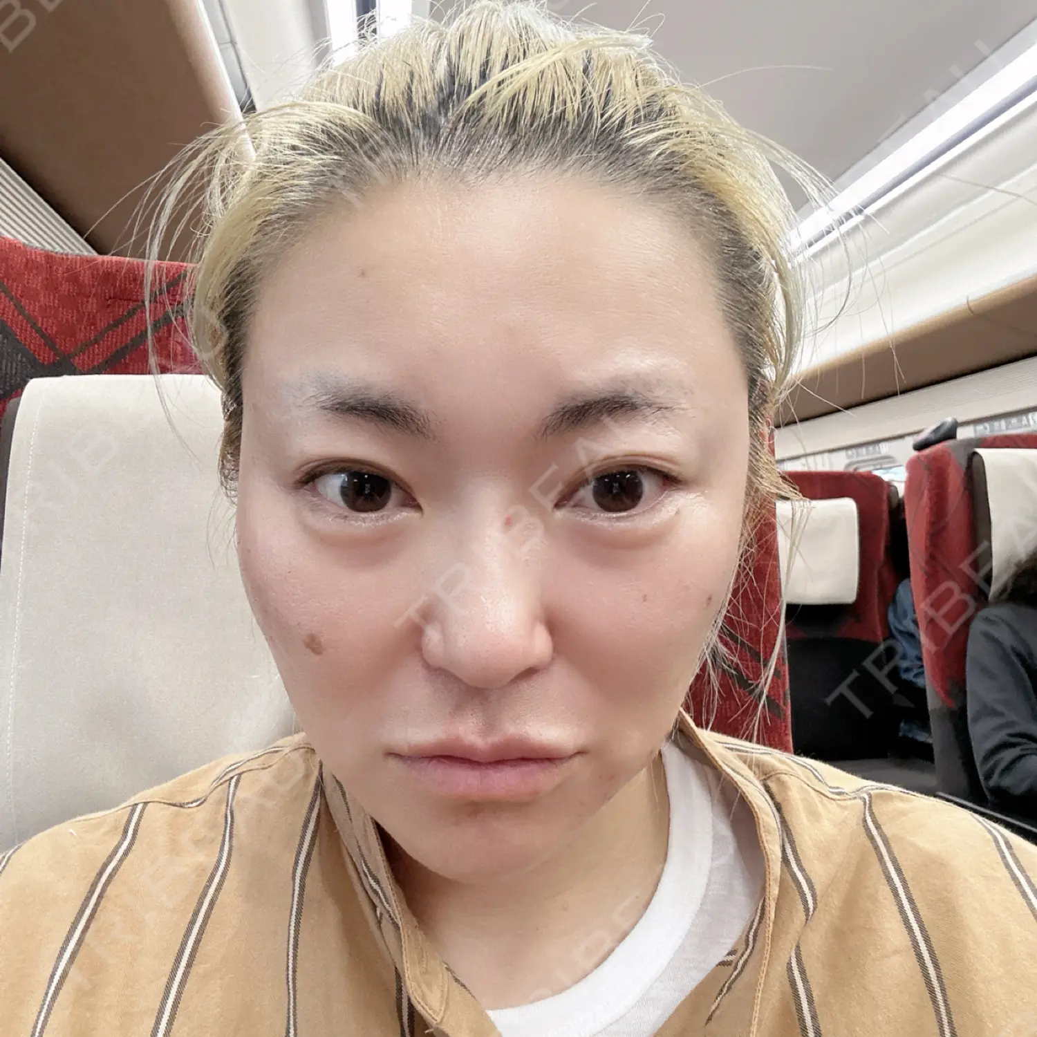 施術前の写真