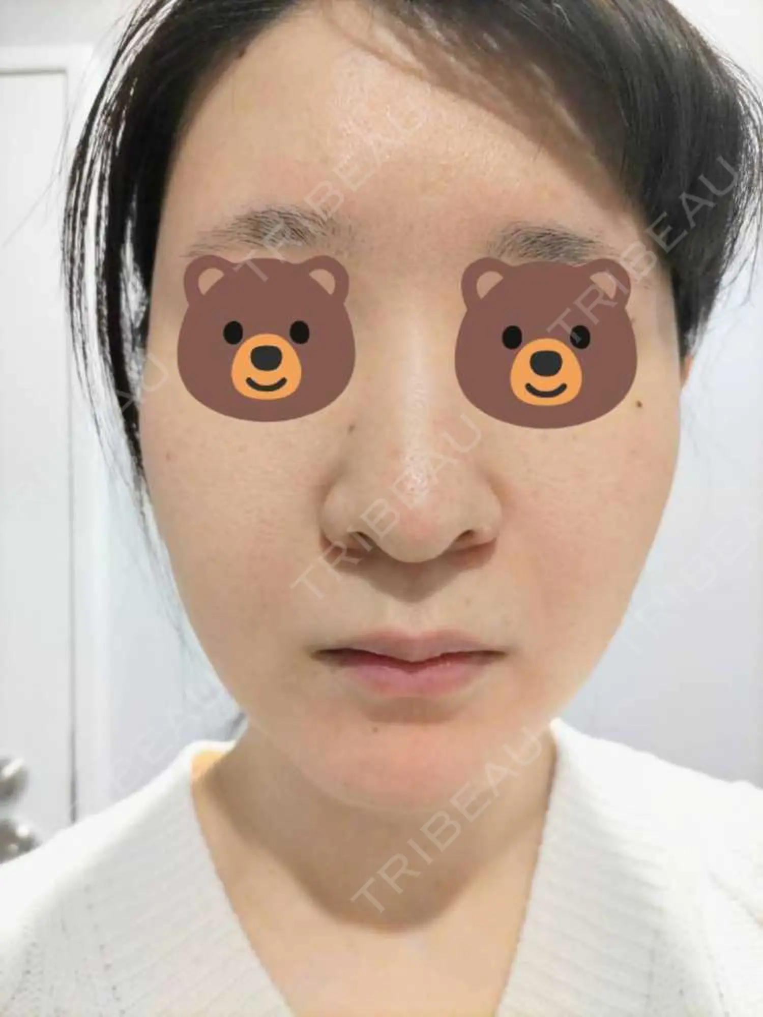 施術前の写真