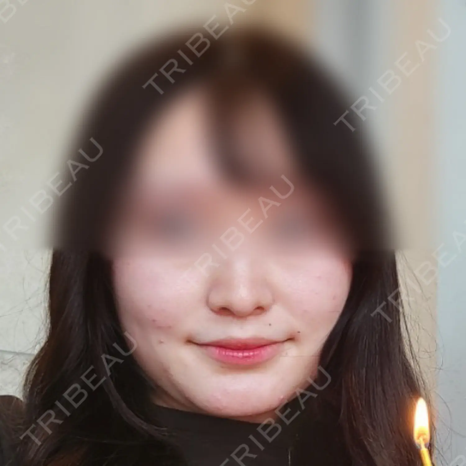 施術前の写真