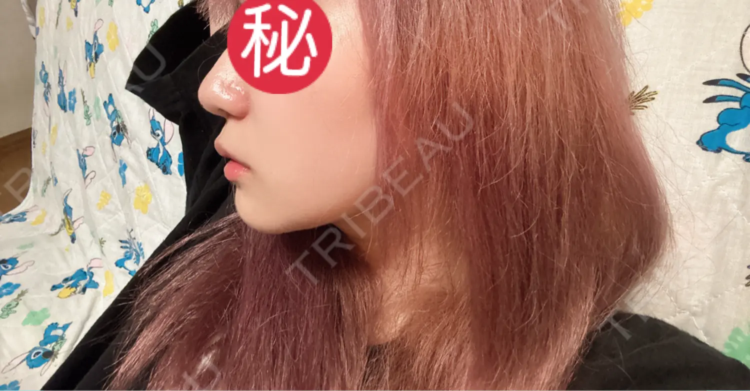 施術前の写真