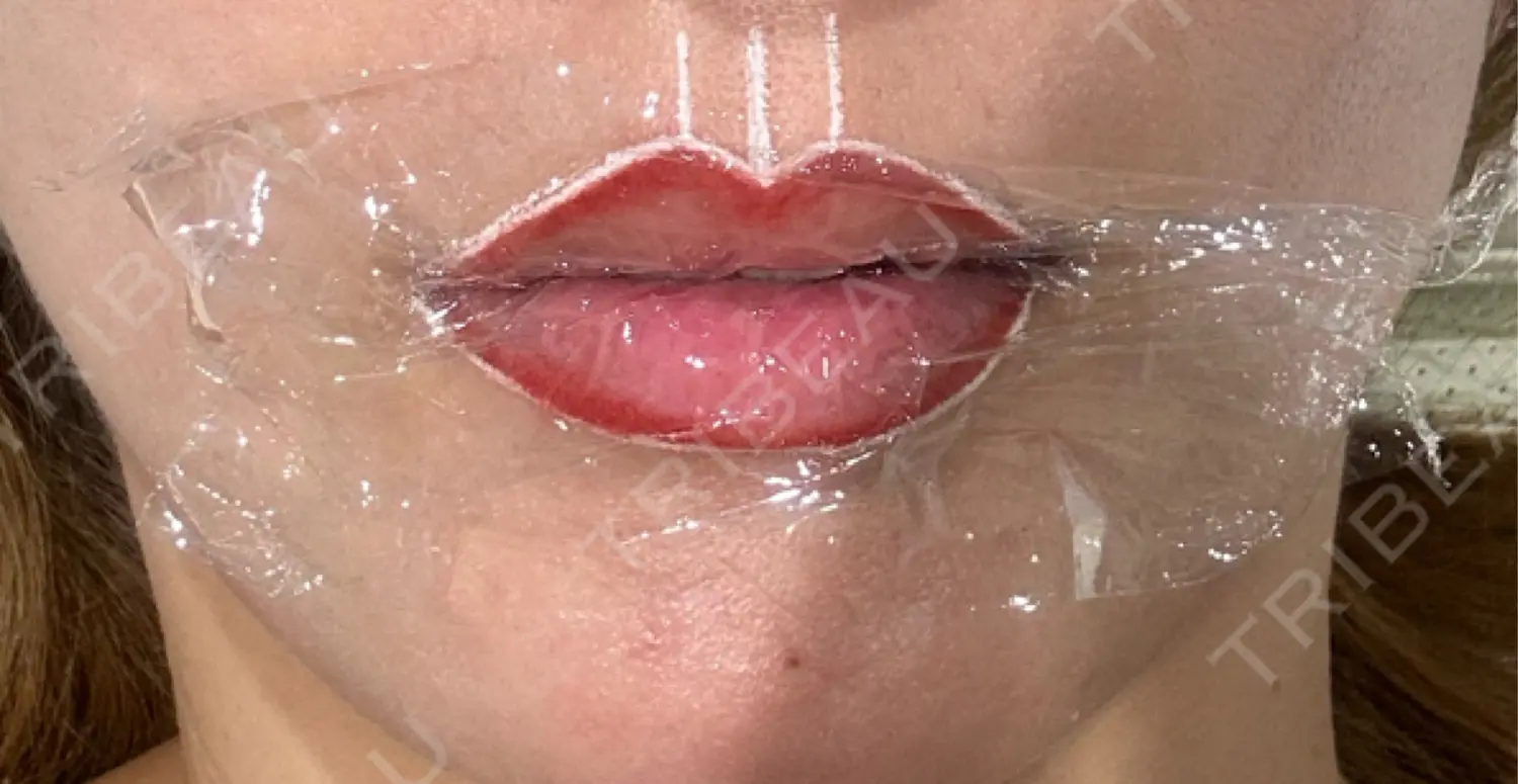 施術前の写真