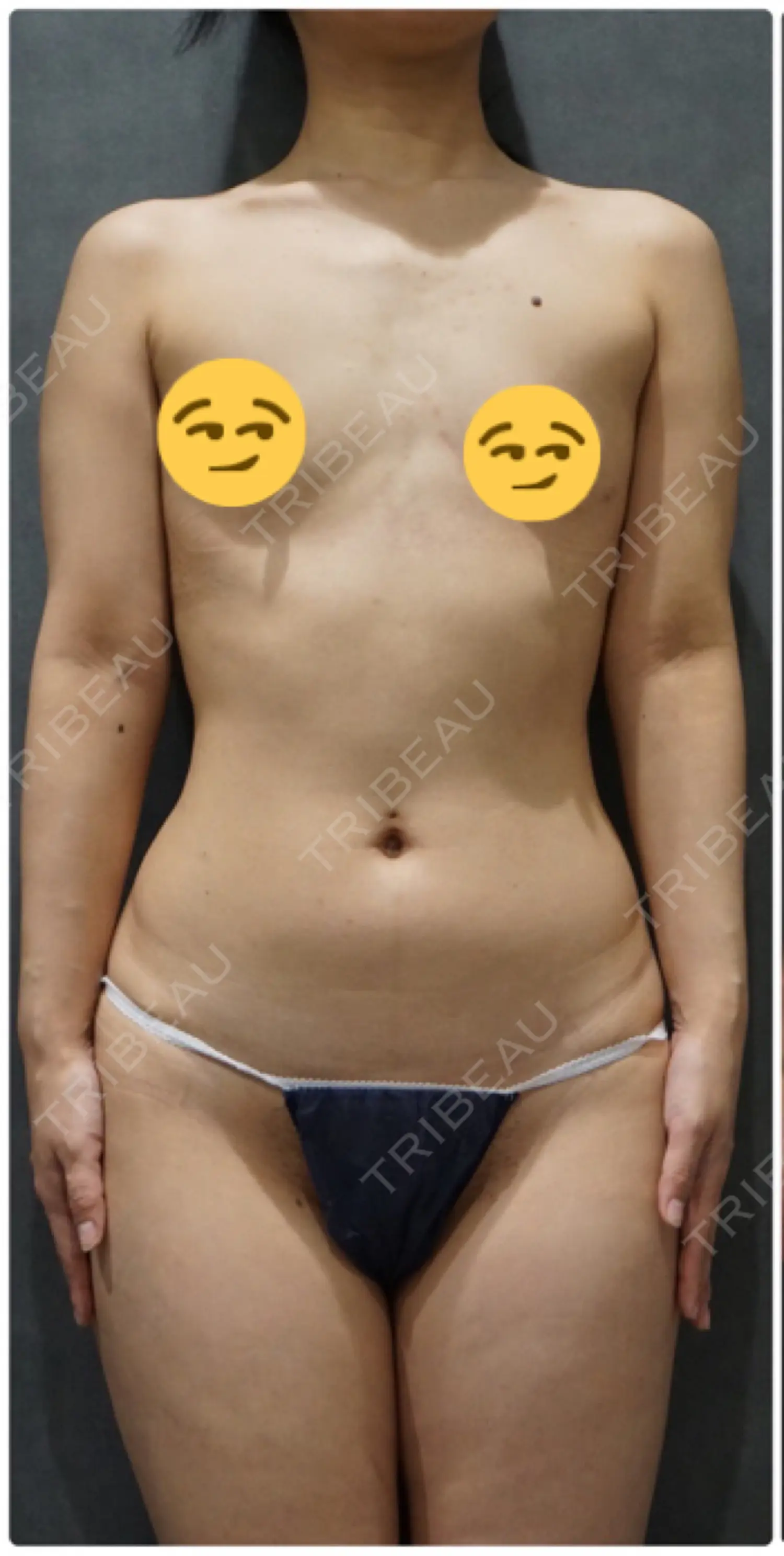 施術前の写真