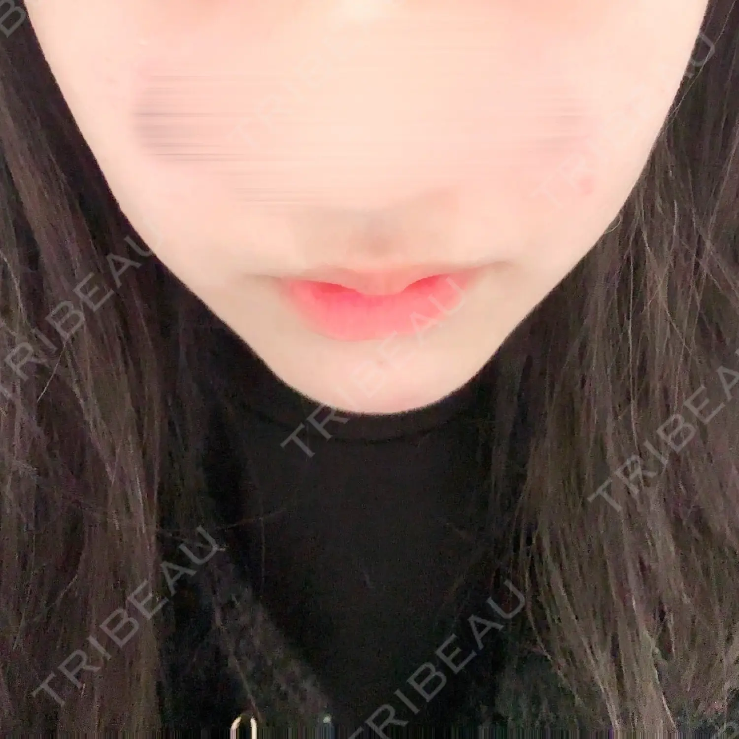 施術前の写真