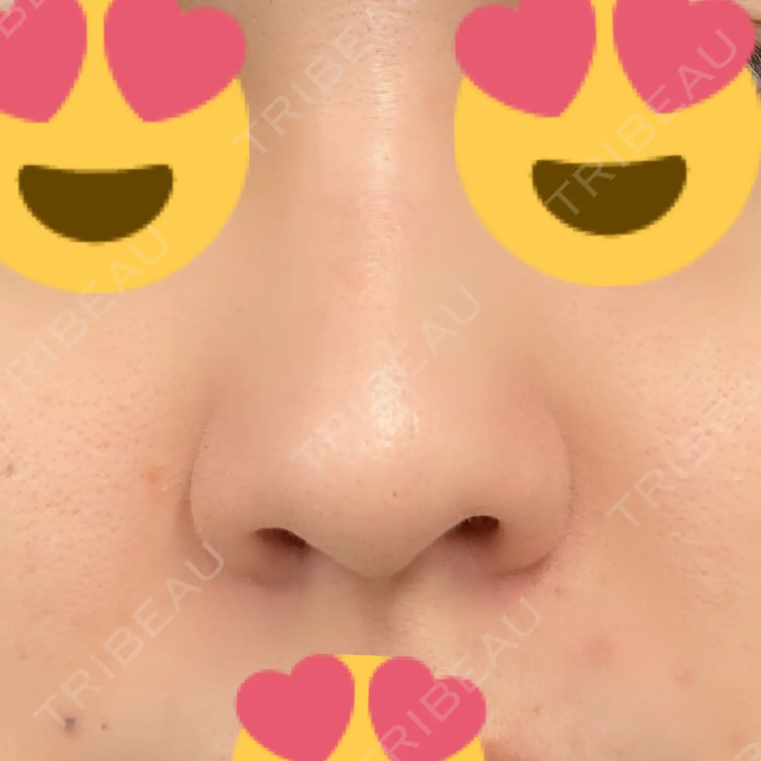 施術前の写真