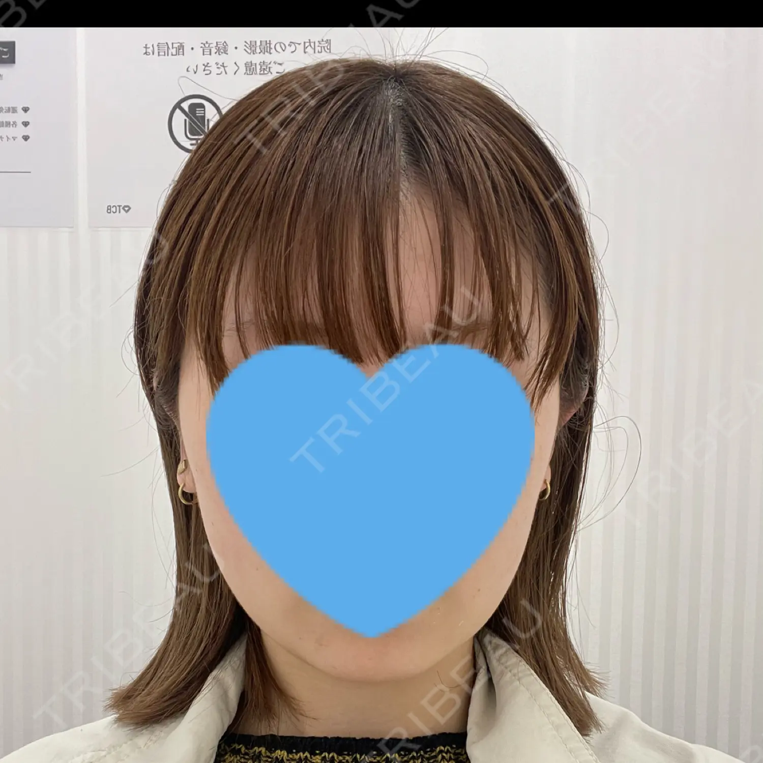 施術前の写真