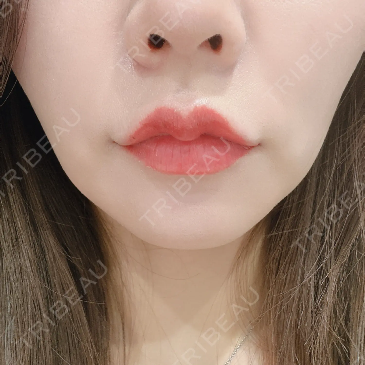 施術前の写真
