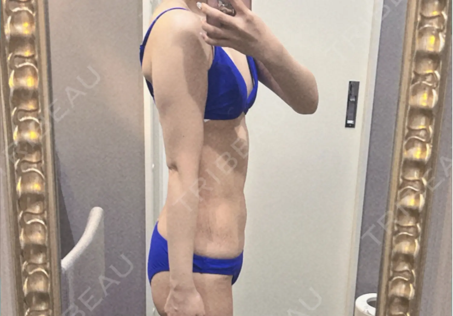 施術前の写真