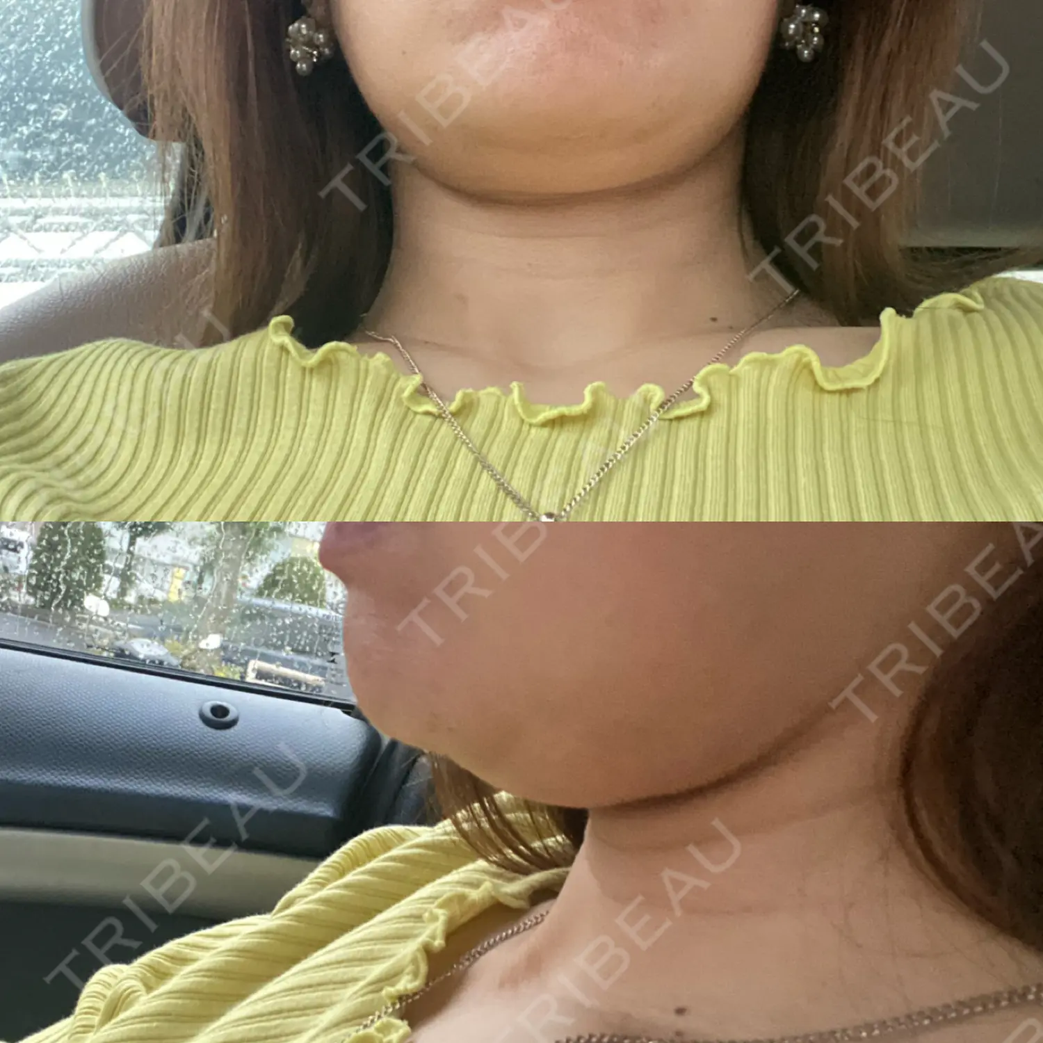 施術前の写真