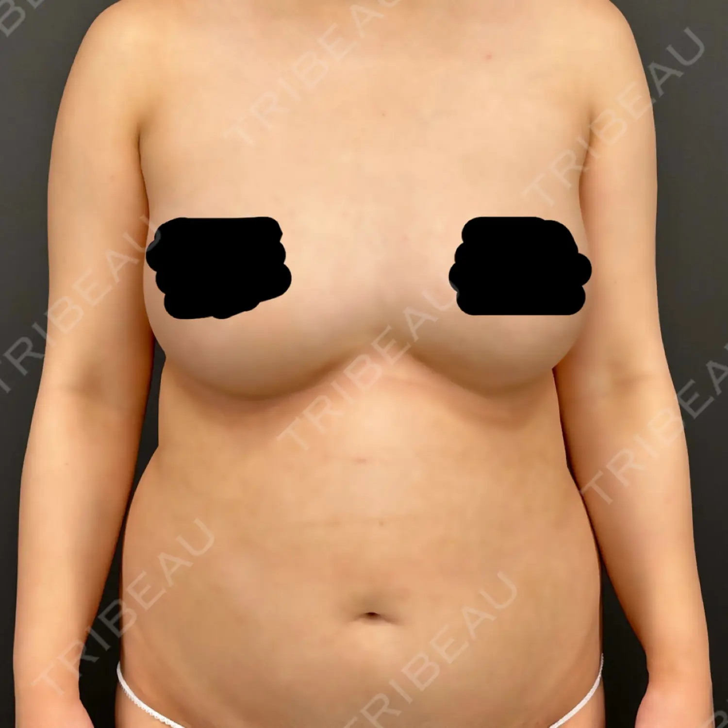 施術前の写真