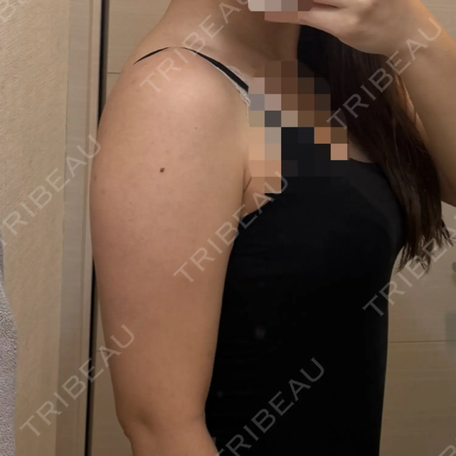 施術前の写真