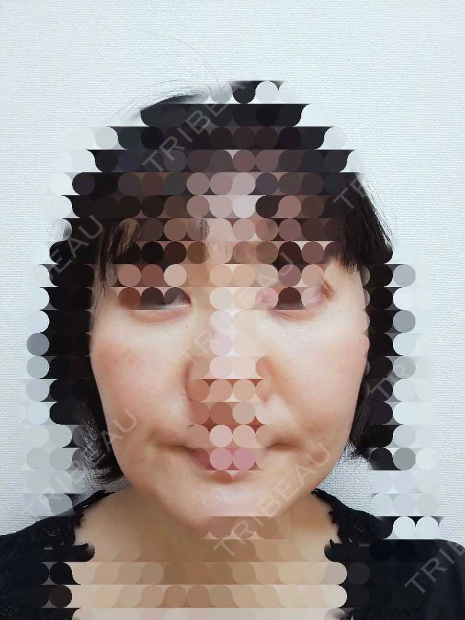 施術前の写真
