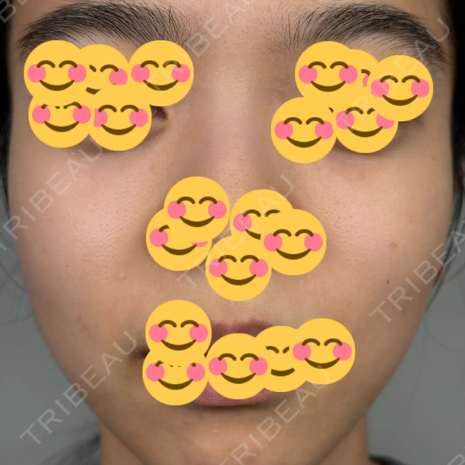 施術前の写真