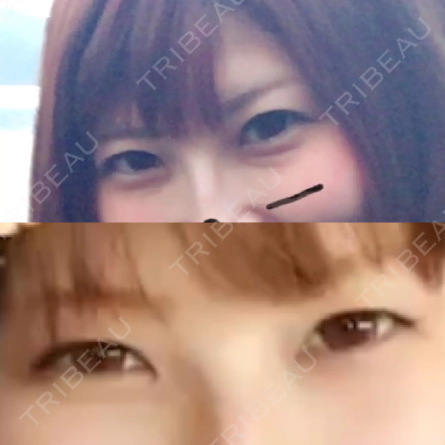 施術前の写真
