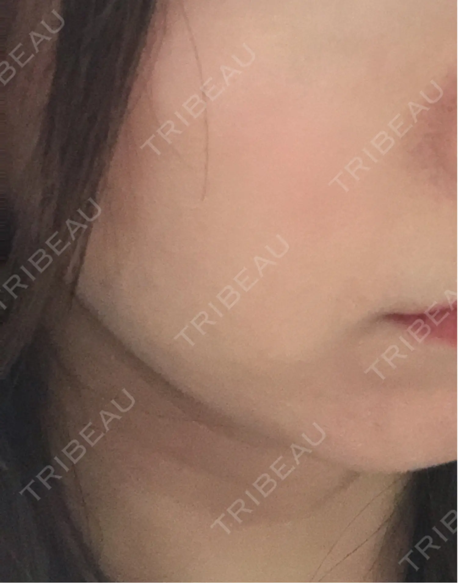 施術前の写真