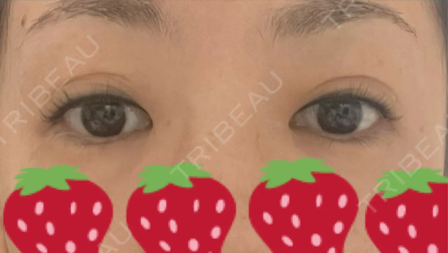 施術前の写真