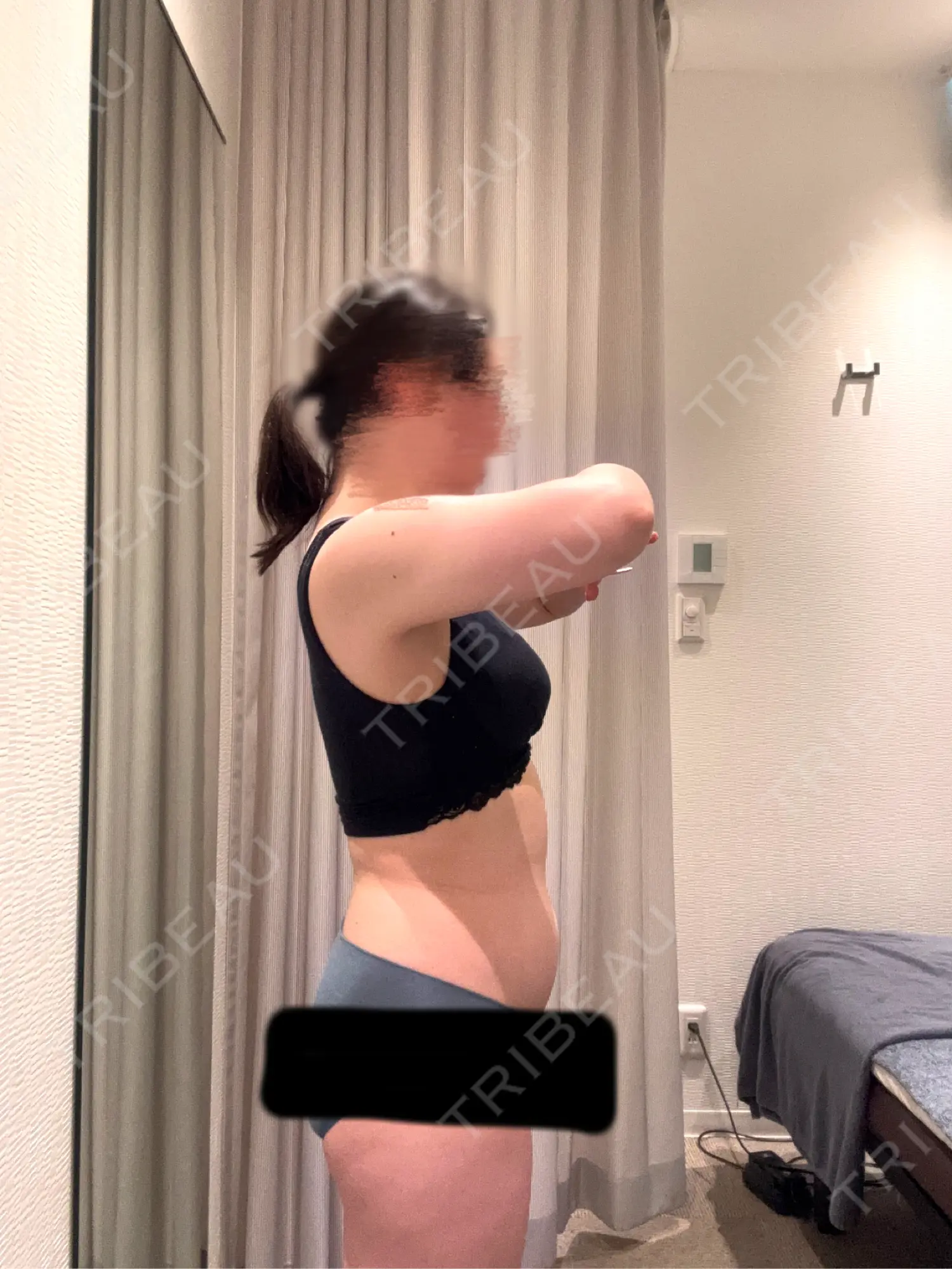 施術前の写真