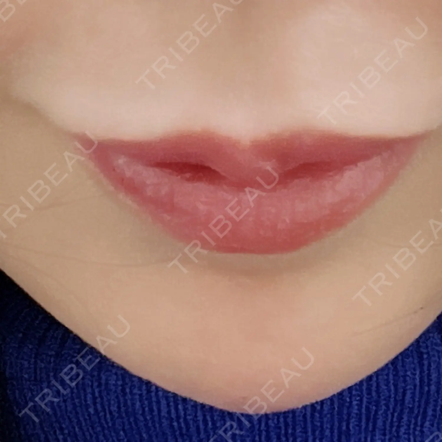 施術前の写真