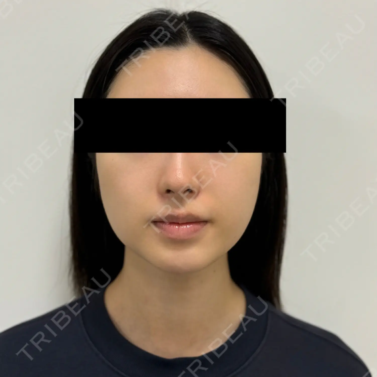 施術前の写真
